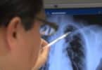 Φυματίωση: “Καμπανάκι” χτυπάνε οι πνευμονολόγοι στη …