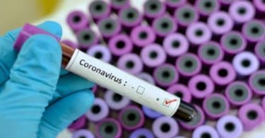 Αυστραλία: Ερευνητές υποστηρίζουν ότι βρήκαν φάρμακo που σκοτώνει τον κορωνοϊό σε 48 ώρες!